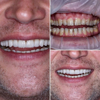 Роман Павличко , Львов Фото - 5