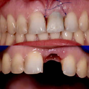 Михайло Сливка Естет, Ужгород Фото - 11