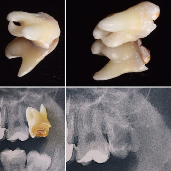 Сергій Крічфалушій , Ужгород Фото - 5