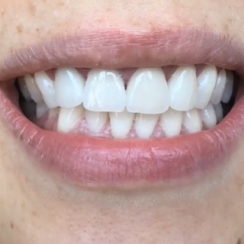 Татевик Мелкумян , Ужгород Фото - 5