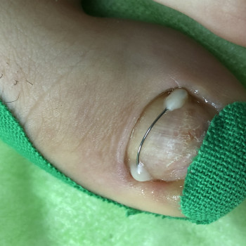 Вероніка Олексієнко, Київ Фото - 19