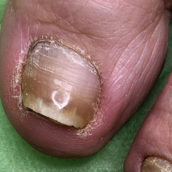 Вероніка Олексієнко, Київ Фото - 7