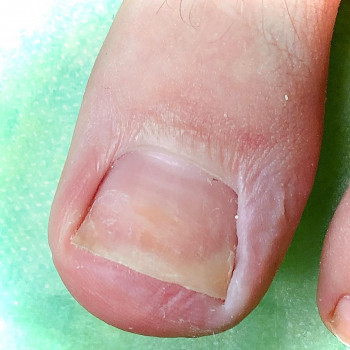 Вероніка Олексієнко, Київ Фото - 5