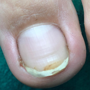 Вероніка Олексієнко, Київ Фото - 4