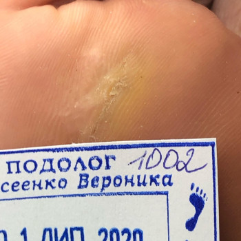 Вероніка Олексієнко, Київ Фото - 11