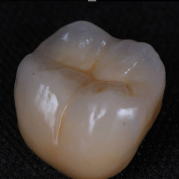 Фото из портфолио специалиста Ігор Вербицький (стоматолог, Тернополь)