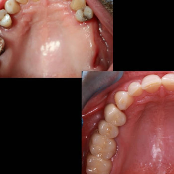 Микола Дутчак , Тернополь Фото - 5