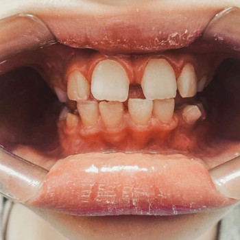 Андрій Вейко , Тернопіль Фото - 7