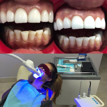 Елена Мокан Мокан, Сумы Фото - 5