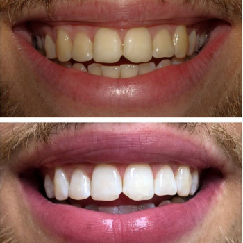 Світлана Москалик , Рівне Фото - 5