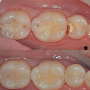 Володимир Гордійчук , Рівне Фото - 6