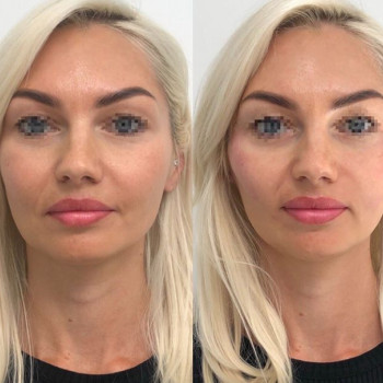 Ольга Печнікова , Ровно Фото - 5