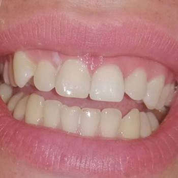 Надія Омельчук , Ровно Фото - 5