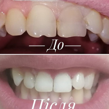 Надія Омельчук , Ровно Фото - 6