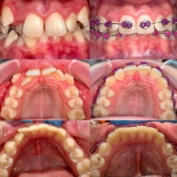 Інна Пекарська , Ровно Фото - 5