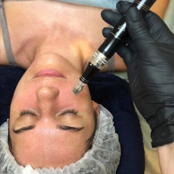 Фото из портфолио косметолога Міла (Львов)