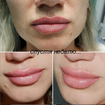 Анна Костюк , Миколаїв Фото - 5