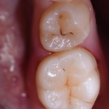 Артем Мирон , Николаев Фото - 5