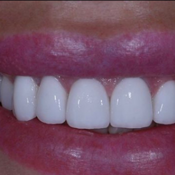 Артем Мирон , Николаев Фото - 6