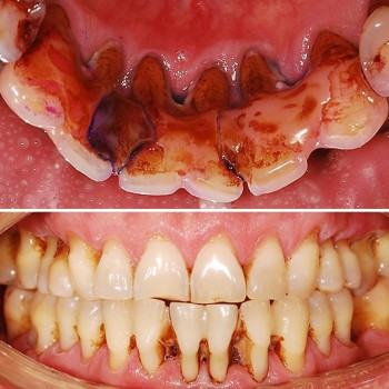 Dent Family, Київ Фото - 5