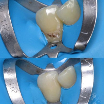 Артем Зарубин , Полтава Фото - 5