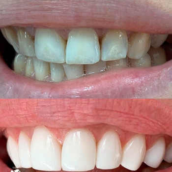 Федір Черевко , Полтава Фото - 5