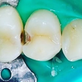 Денис Солошенко , Полтава Фото - 6