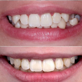 Марія Кириленко , Полтава Фото - 5