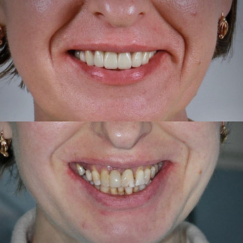 Larosh, Харьков Фото - 5