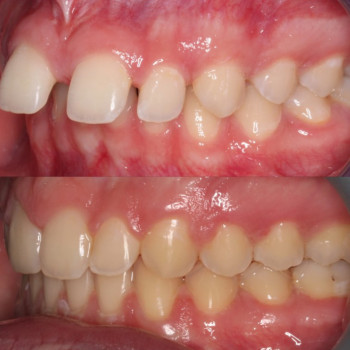 Андрій Кирилюк , Ивано-Франковск Фото - 5