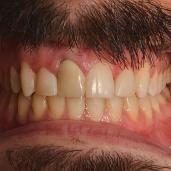 Ігор Федорняк, Ивано-Франковск Фото - 5