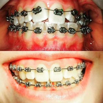 Тарас Авраменко , Ивано-Франковск Фото - 5