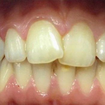 Ірина Тимофійчук , Ивано-Франковск Фото - 5