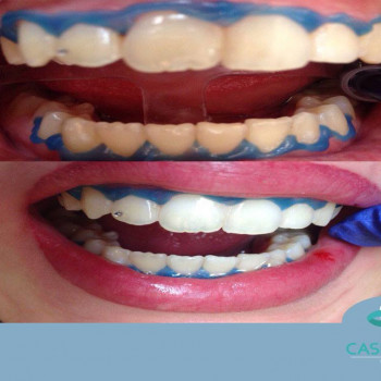 CaspiDent, Харьков Фото - 5