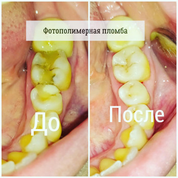 Dental Studio, Днепр Фото - 6