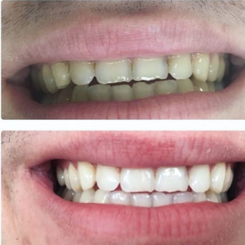 Мар'яна Остапяк , Івано-Франківськ Фото - 5