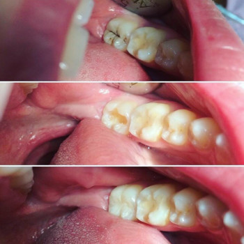 Мар'яна Остапяк , Івано-Франківськ Фото - 6