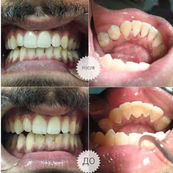 Ольга Ревенко , Кропивницкий Фото - 5