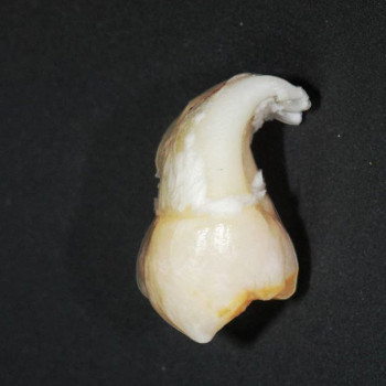 Дмитрий Лисненко , Кропивницкий Фото - 3