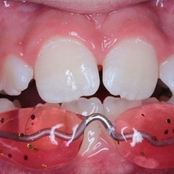 Rocketsmile, Дніпро Фото - 5