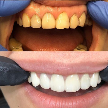 Михайло Дюрдяй , Луцьк Фото - 7