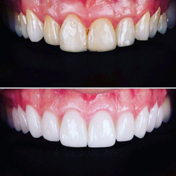 ПрофиДент, Дніпро Фото - 5