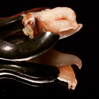 Олексій Кереб , Луцьк Фото - 5