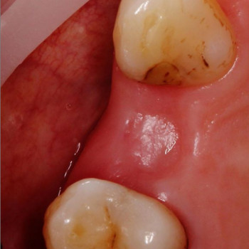 Олексій Кереб , Луцьк Фото - 6