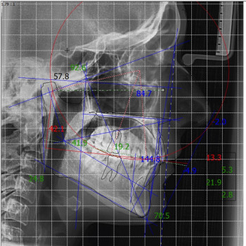 Dent-Studia, Дніпро Фото - 7