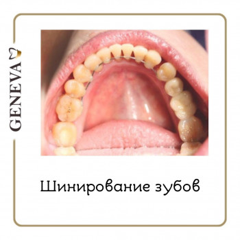 Geneva, Одеса Фото - 5