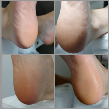 Ольга Подолог, Бровари Фото - 5