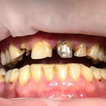 Назар Авраменко, Винница Фото - 5