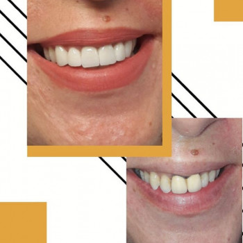 Ольга Харчук, Винница Фото - 5