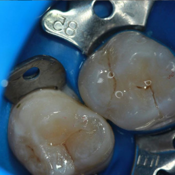 Максим Мосейчук, Винница Фото - 5